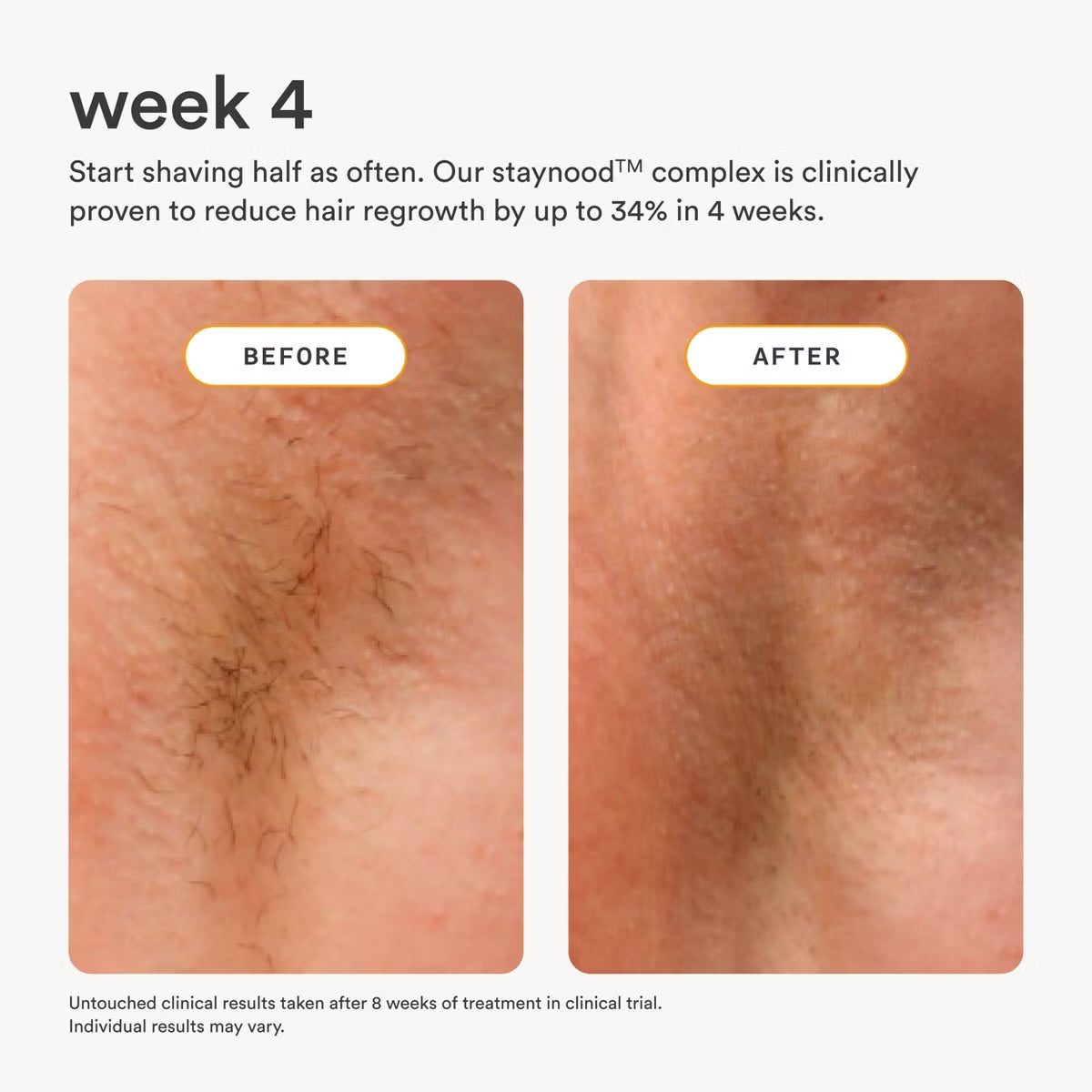 Nood After Care Serum - 3.3 fl oz