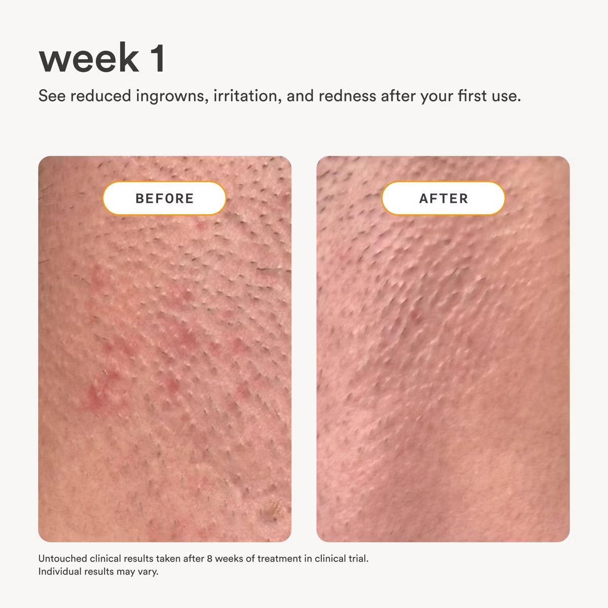 Nood After Care Serum - 3.3 fl oz